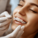 Invisalign